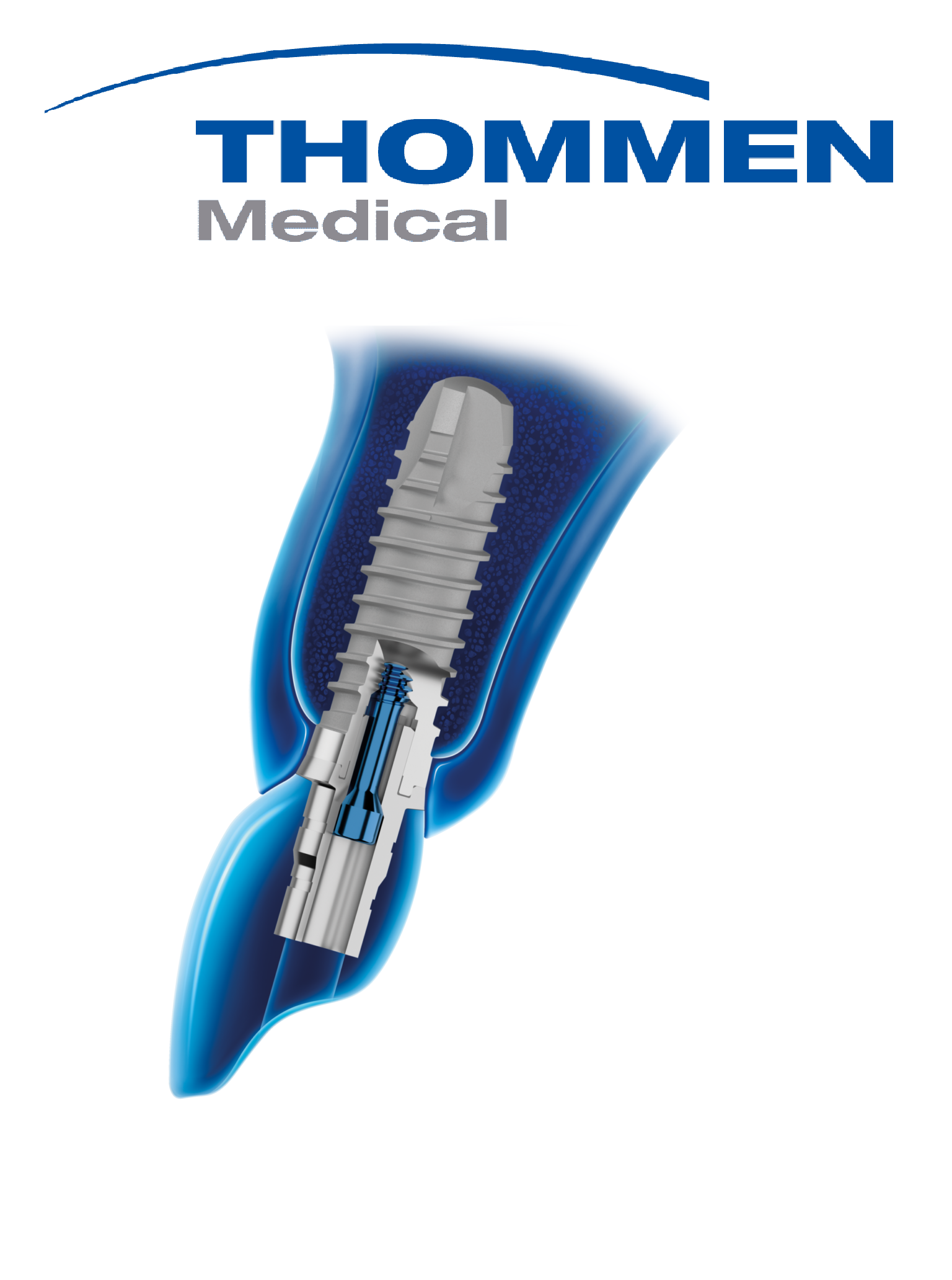 Dental implants Szczecin