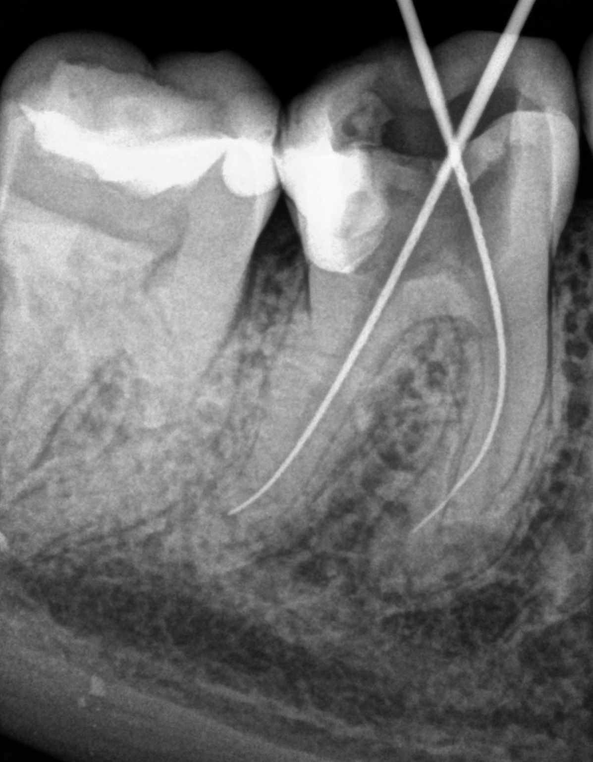 Digital dental X-ray Szczecin